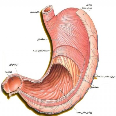 تنگی پیلور چیست و چه علائمی دارد؟