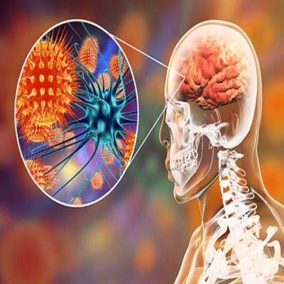 تأثیر کرونا بر مغز