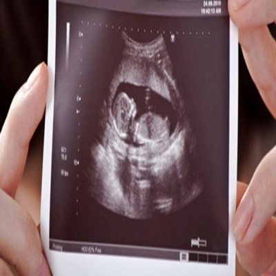 تلاش مجلس برای حذف غربالگری اجباری/ سرانجام قانون غربالگری جنین چه خواهد شد؟