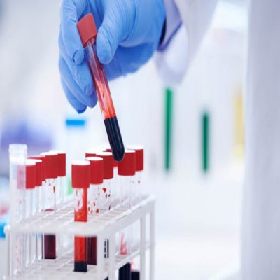 آزمایش هایی که قبل از بارداری حتما باید انجام دهید