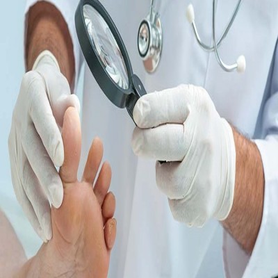 عفونت‌های پوستی شایع در فصل گرما