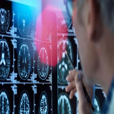 حقیقت یا شایعه/ آیا ویدئوهای کوتاه واقعاً مغز را دچار زوال می‌کنند؟